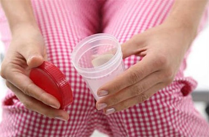 Для обнаружения следов крови в кале назначают анализ испражнений на скрытую кровь