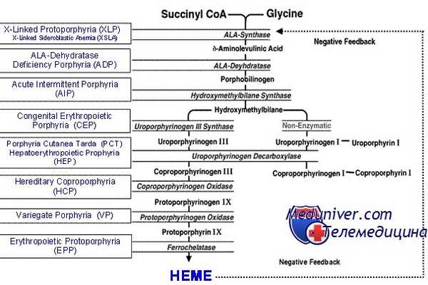 Острая перемежающаяся порфирия