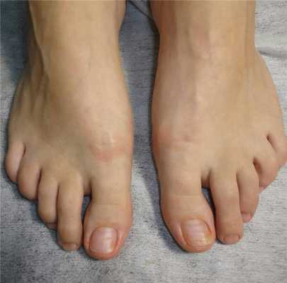 Комбинированный педикюр в домашних условиях