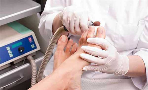 Медицинский педикюр