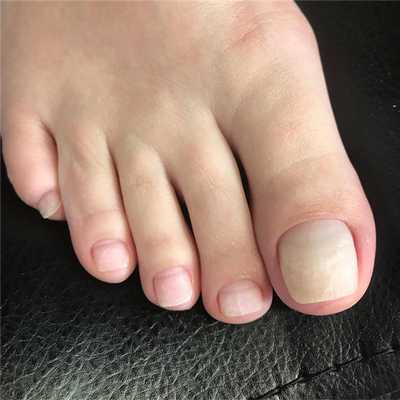 Классический педикюр фото после процедуры