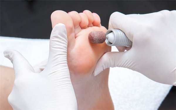 Обработка стоп при аппаратном педикюре