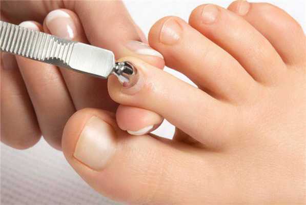 Классический педикюр специальными инструментами