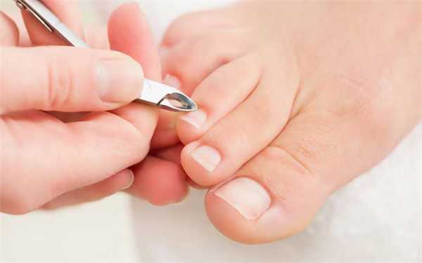 Педикюр: удаление кутикулы кусачками