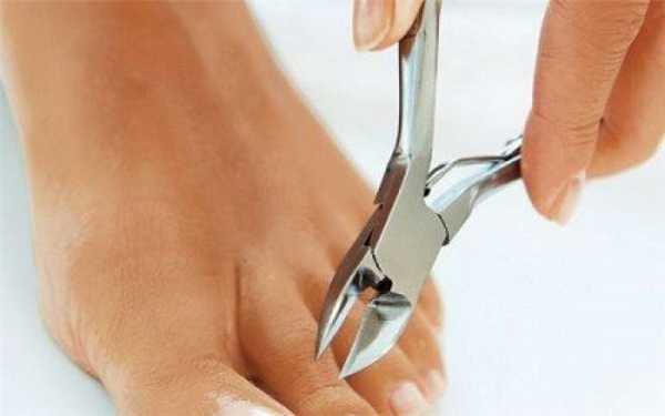 Обрезной педикюр с использованием кусачек