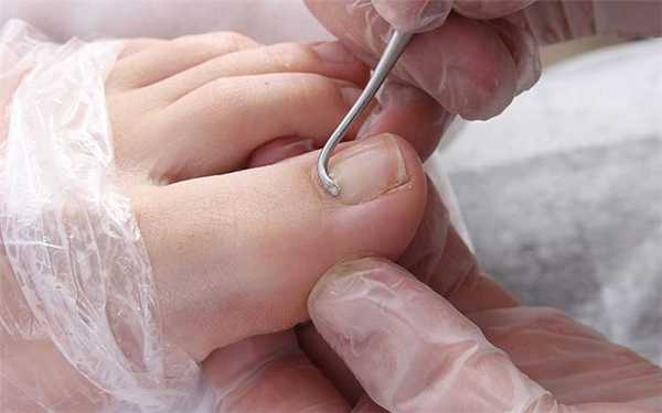 Бразильский вид педикюра