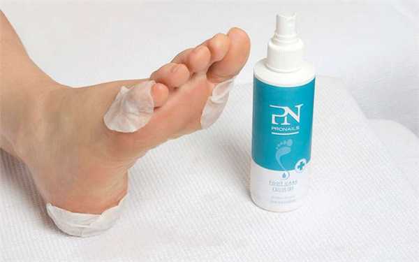 Препаратный педикюр: удаление мозолей и натоптышей