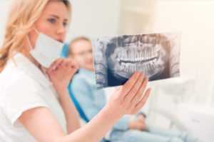 снимок челюсти