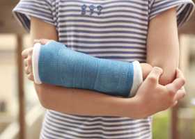 Гипсовая повязка при переломе лучевой кости