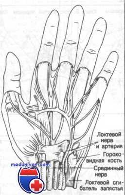 переломы костей запястья