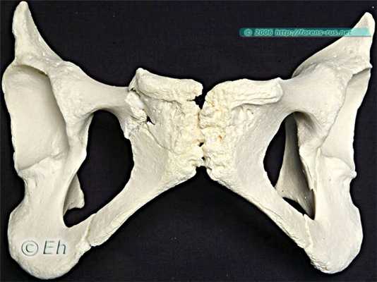 Повреждения переднего полукольца таза при переезде колесом автомобиля