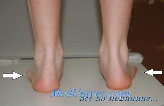 ганглии стопы у танцоров