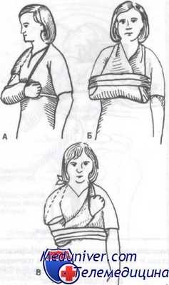 переломы проксимального отдела плечевой кости