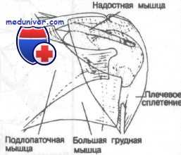 переломы проксимального отдела плечевой кости