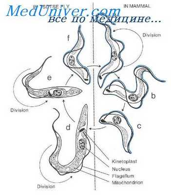 трипаносомоз