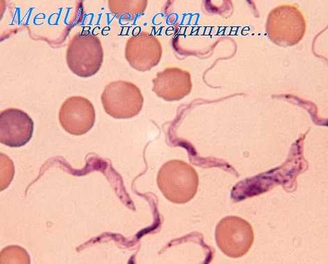 распространение трипаносомоза