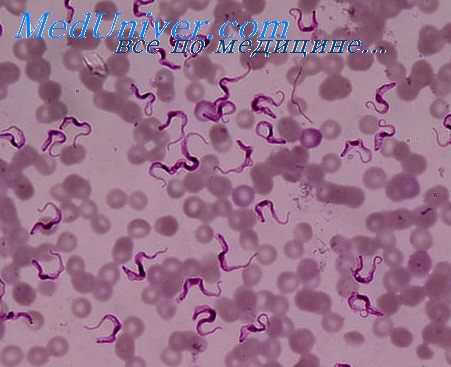 американский трипаносомоз