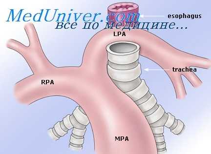 легочная артерия