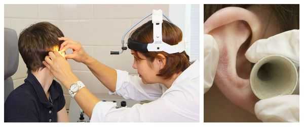 Обычная отоскопия с использованием воронки