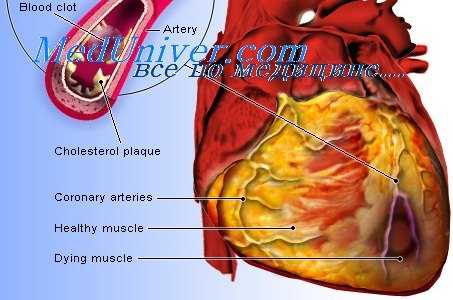 дегенеративные заболевания