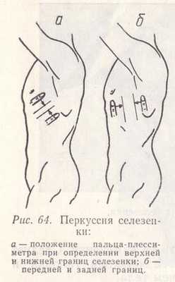 Перкуссия селезенки