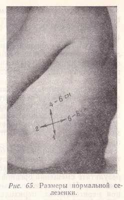 Размеры нормальной селезенки