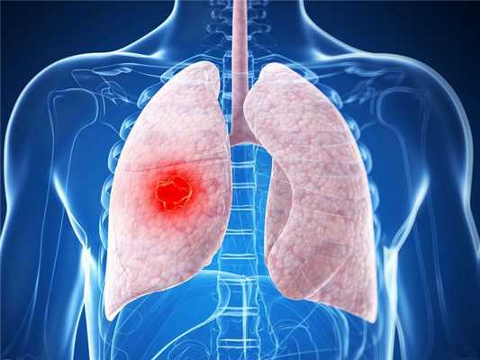 Скрытая пневмония