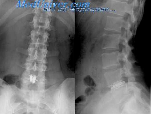 эндохирургическая операционная