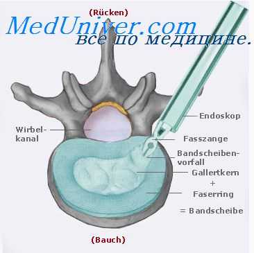 эндоскопическая операционная