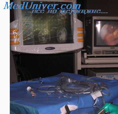 нейроэндоскопические операции