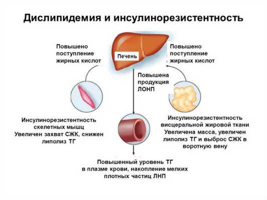 Дислипидемия