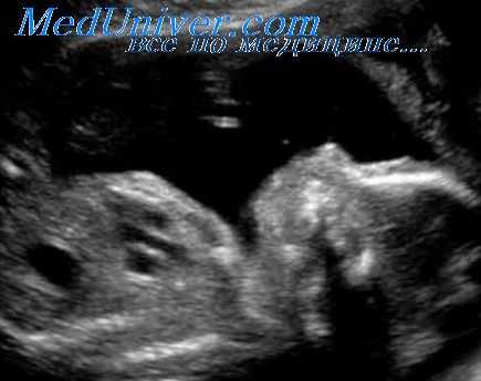 брюшина эмбриона