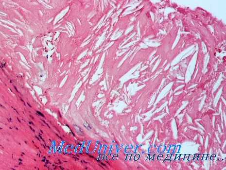 влияние адреналина на коагуляцию