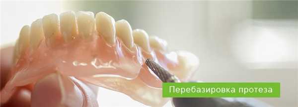 Перебазировка протеза: методы коррекции
