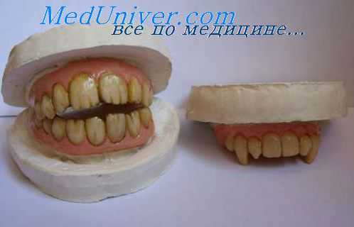 парестезии протезов