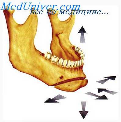 формирующие аппараты