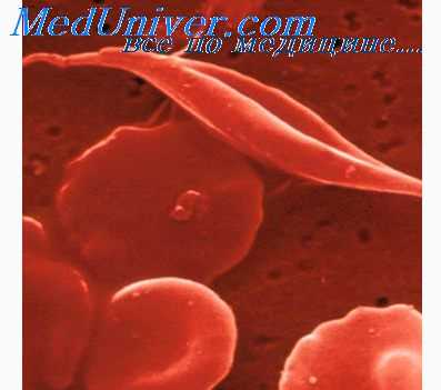 гемолитическая болезнь