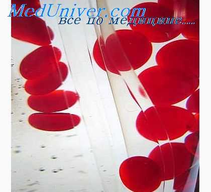 гемолитическая болезнь