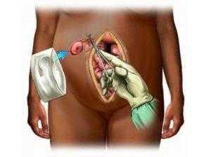 Одноствольная