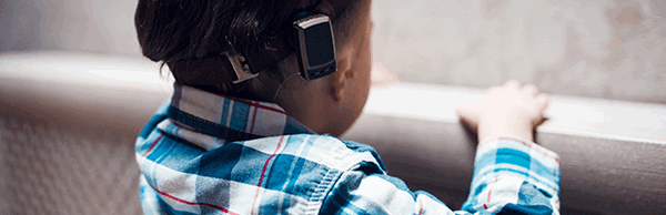 У Димы двусторонняя микротия, Baha помогает ему слышать