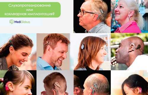 Что такое слуховой аппарат, кохлеарная имплантация, показания, противпоказания