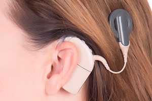 Личный опыт: плюсы и минусы кохлеарной имплантации для взрослых