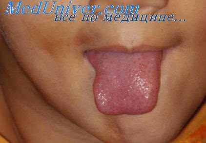 пневмоэнцефалография