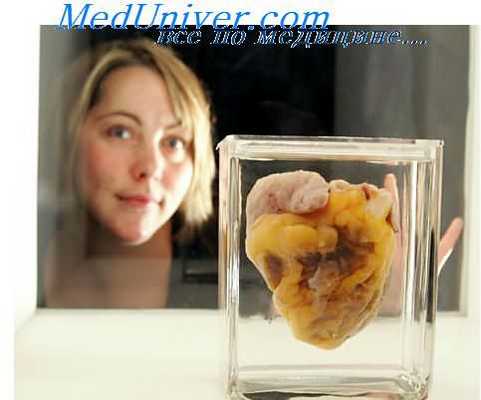 нарушения ритма сердца