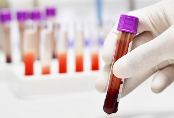 Респираторный ацидоз