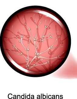 Аллергический хейлит