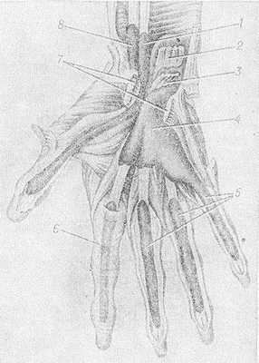 Рис. 2. Синовиальные влагалища сухожилий на ладонной поверхности кисти: 1 — синовиальное влагалище сухожилия длинного сгибателя большого пальца кисти; 2 — сухожилие глубокого сгибателя пальцев (отсечено); 3 — сухожилие поверхностного сгибателя пальцев (отсечено); 4 — общее синовиальное влагалище сгибателей; 5 — синовиальные влагалища сухожилий пальцев кисти; 6 — фиброзная часть влагалища сухожилия II пальца; 7 — удерживатель сгибателей (пересечен); 8 — синовиальное влагалище сухожилия лучевого сгибателя запястья.