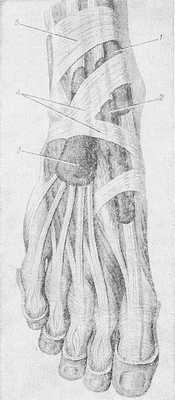 Рис. 4. Синовиальные влагалища сухожилий на тыльной поверхности стопы: 1 — влагалище сухожилия передней большеберцовой мышцы; 2 — влагалище сухожилия длинного разгибателя большого пальца стопы; 3 — влагалище сухожилий длинного разгибателя пальцев стопы; 4 — нижний удерживатель сухожилий-разгибателей; 5 — верхний удерживатель сухожилий-разгибателей.