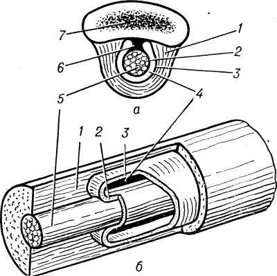 Рис. 1. Схематическое изображение влагалища сухожилия: а — поперечный разрез фаланги пальца с сухожилием сгибателя пальца и влагалищем сухожилия; б — послойно отпрепарированное влагалище сухожилия; 1 — стенка костно-фиброзного (на нижнем рисунке — фиброзного) канала; 2 — висцеральная часть синовиального влагалища; 3 — париетальная часть синовиального влагалища; 4 — синовиальная полость; 5 — сухожилие; 6 — брыжейка сухожилия; 7 — кость.