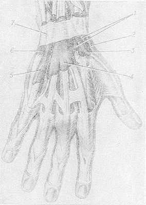 Рис. 3. Синовиальные влагалища сухожилий на тыльной поверхности кисти: 1 — влагалище сухожилий лучевых разгибателей запястья; 2 — влагалище сухожилий длинной отводящей мышцы и короткого разгибателя большого пальца кисти; 3 — влагалище сухожилия длинного разгибателя большого пальца кисти; 4 — влагалище сухожилий разгибателей пальцев и указательного пальца; 5 — влагалище сухожилия разгибателя мизинца; 6 — влагалище сухожилия локтевого разгибателя запястья; 7 — удерживатель разгибателей.